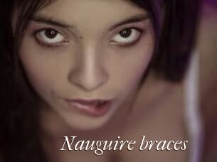 Nauguire_braces